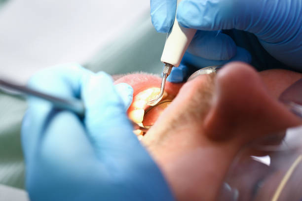 Best Emergency Gum Pain Relief  in Parker, FL